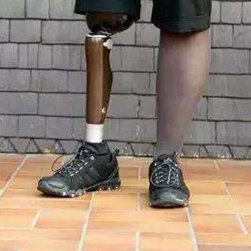 一款假肢脚板是不是适合每一位截肢患者